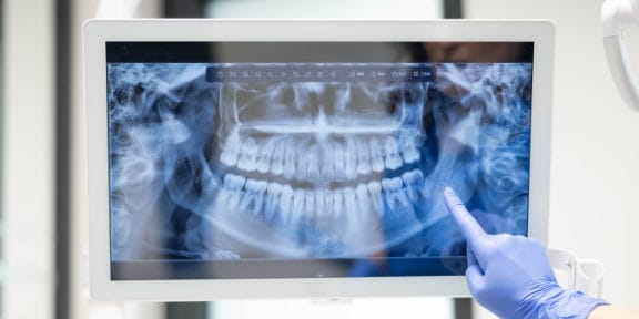Digital X-Rays